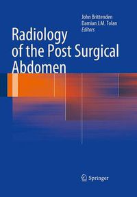 Cover image for Radiology of the Post Surgical Abdomen