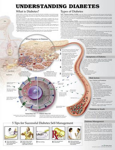 Cover image for Understanding Diabetes Anatomical Chart