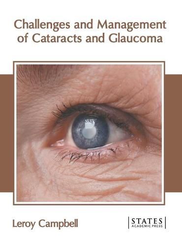 Cover image for Challenges and Management of Cataracts and Glaucoma