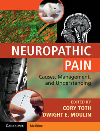 Cover image for Neuropathic Pain: Causes, Management and Understanding