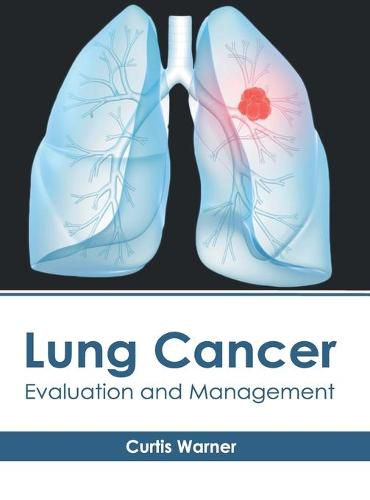 Cover image for Lung Cancer: Evaluation and Management