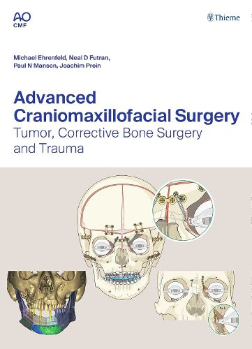 Cover image for Advanced Craniomaxillofacial Surgery: Tumor, Corrective Bone Surgery, and Trauma