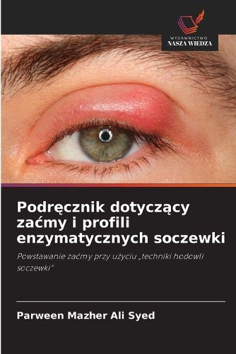 Cover image for Podręcznik dotyczący zacmy i profili enzymatycznych soczewki
