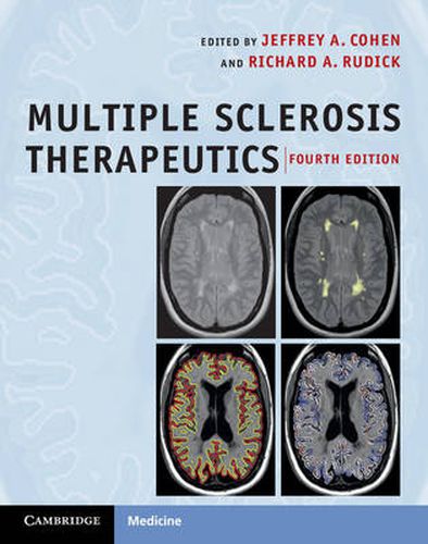 Cover image for Multiple Sclerosis Therapeutics