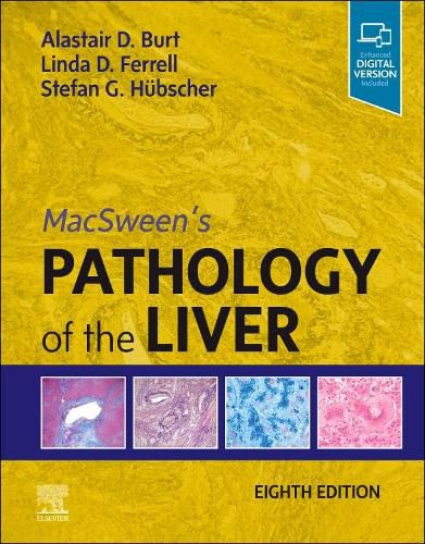 Cover image for MacSween's Pathology of the Liver