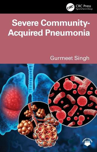 Cover image for Severe Community-Acquired Pneumonia