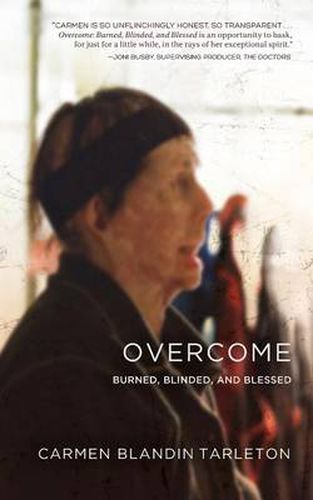 Cover image for Overcome: Burned, Blinded, and Blessed