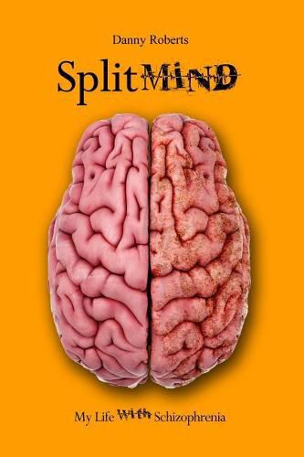 Cover image for Split Mind: My Life with Schizophrenia