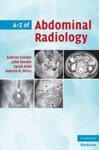 Cover image for A-Z of Abdominal Radiology