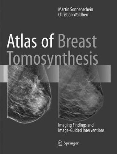 Cover image for Atlas of Breast Tomosynthesis: Imaging Findings and Image-Guided Interventions