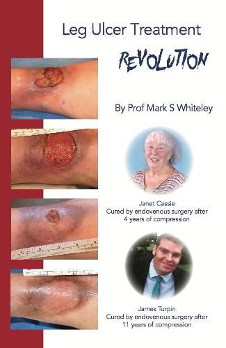 Cover image for Leg Ulcer Treatment Revolution