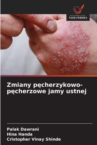 Cover image for Zmiany pęcherzykowo-pęcherzowe jamy ustnej