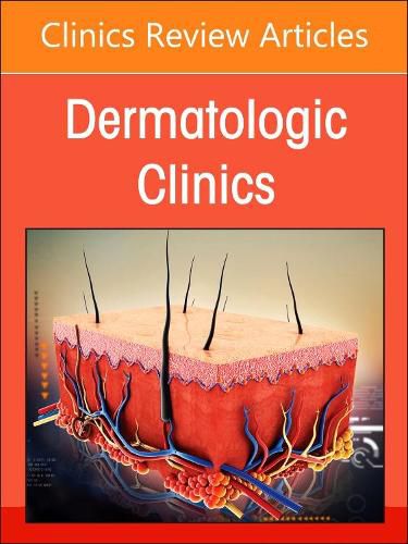 Diversity, Equity, and Inclusion in Dermatology, An Issue of Dermatologic Clinics: Volume 41-2