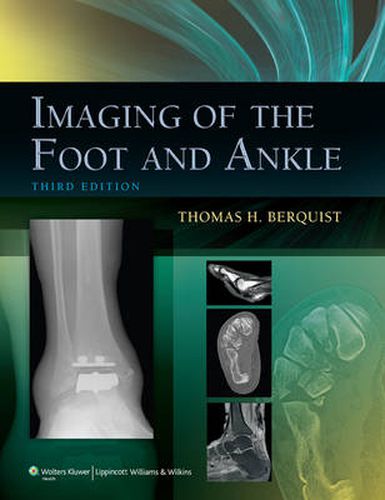 Cover image for Imaging of the Foot and Ankle