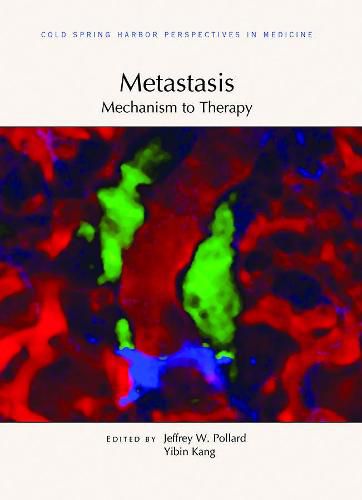 Cover image for Metastasis: Mechanism to Therapy