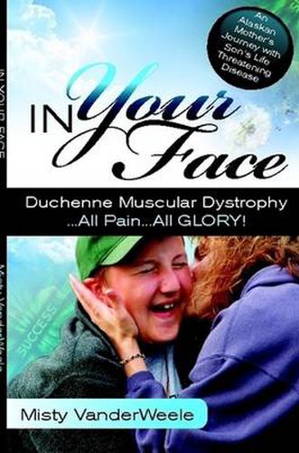 Cover image for In Your Face Duchenne Muscular Dystrophy All Pain All Glory