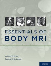 Cover image for Essentials of Body MRI