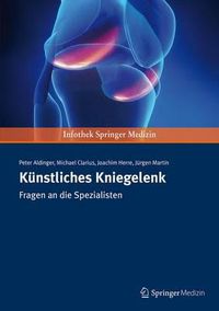 Cover image for Kunstliches Kniegelenk: Fragen an die Spezialisten