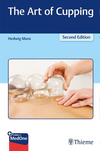 Cover image for The Art of Cupping