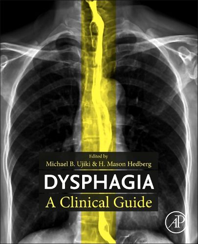 Cover image for Dysphagia