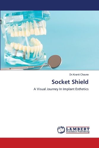Cover image for Socket Shield