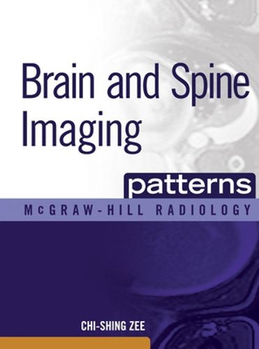 Cover image for Brain and Spine Imaging Patterns