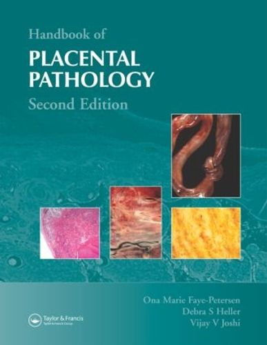 Cover image for Handbook of Placental Pathology