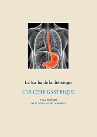 Cover image for Le b.a-ba de la dietetique pour l'ulcere gastrique