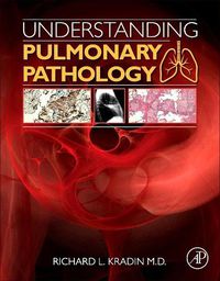 Cover image for Understanding Pulmonary Pathology: Applying Pathological Findings in Therapeutic Decision Making