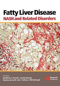 Cover image for Fatty Liver Disease: NASH and Related Disorders