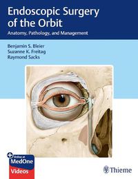 Cover image for Endoscopic Surgery of the Orbit: Anatomy, Pathology, and Management