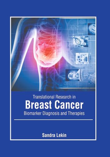 Cover image for Translational Research in Breast Cancer: Biomarker Diagnosis and Therapies