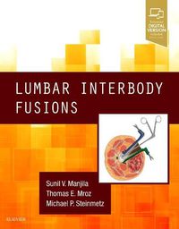 Cover image for Lumbar Interbody Fusions