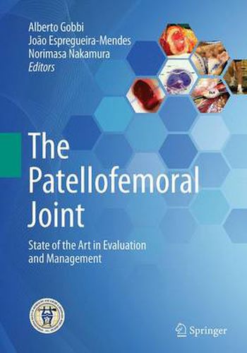 Cover image for The Patellofemoral Joint: State of the Art in Evaluation and Management