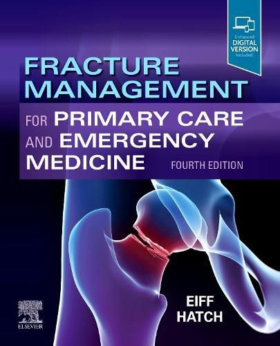 Cover image for Fracture Management for Primary Care and Emergency Medicine