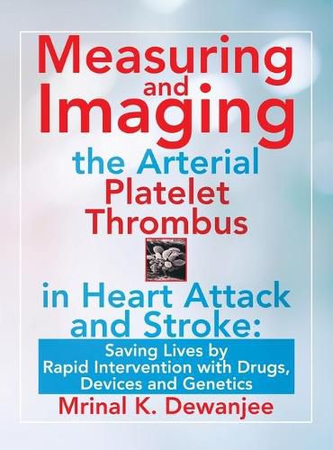 Cover image for Measuring and Imaging the Arterial Platelet Thrombus in Heart Attack and Stroke