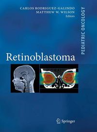 Cover image for Retinoblastoma