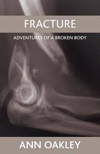 Fracture: Adventures of a broken body