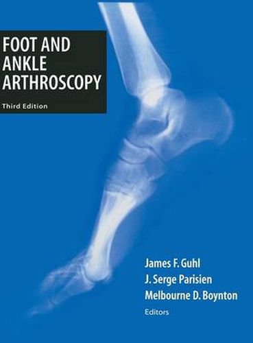 Cover image for Foot and Ankle Arthroscopy