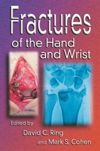 Cover image for Fractures of the Hand and Wrist