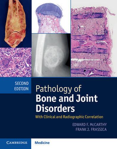 Cover image for Pathology of Bone and Joint Disorders Print and Online Bundle: With Clinical and Radiographic Correlation