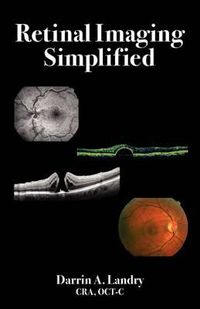 Cover image for Retinal Imaging Simplified