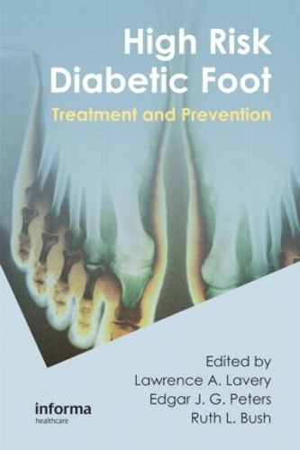 Cover image for High Risk Diabetic Foot: Treatment and Prevention