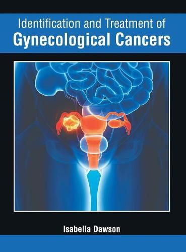 Cover image for Identification and Treatment of Gynecological Cancers