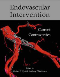 Cover image for Endovascular Intervention: Current Controversies