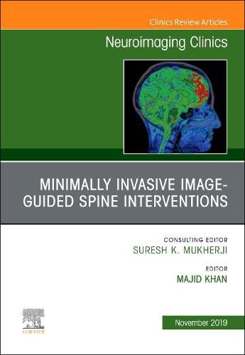 Cover image for Spine Intervention, An Issue of Neuroimaging Clinics of North America