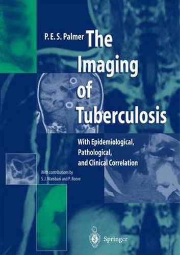 Cover image for The Imaging of Tuberculosis: With Epidemiological, Pathological, and Clinical Correlation