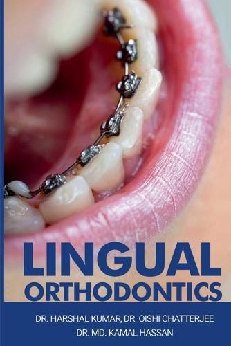 Cover image for Lingual Orthodontics