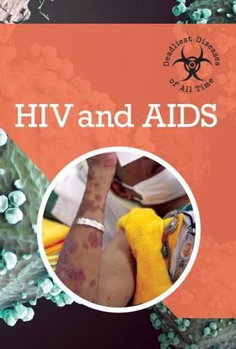 Cover image for HIV and AIDS