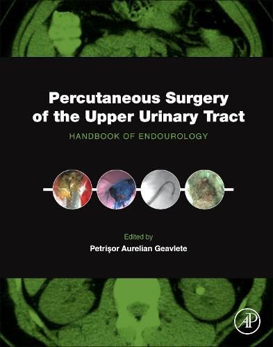 Cover image for Percutaneous Surgery of the Upper Urinary Tract: Handbook of Endourology
